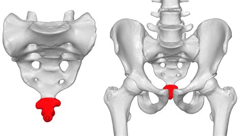 Coccydynia: Definition - Spine Info