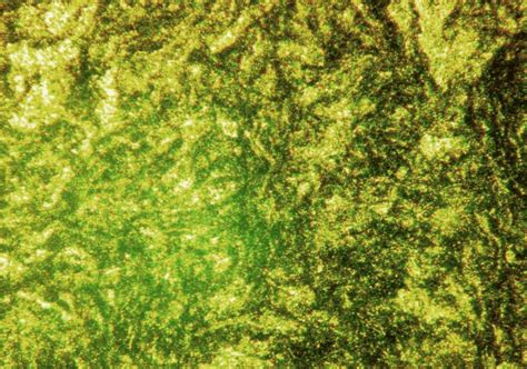 Microstructure of (a) Al alloy -15% SiC), (b) Al alloy -10% SiC) (c) Al ...