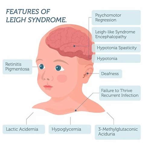 Leigh Syndrome Treatment at Rs 111/month in Noida | ID: 26026663930