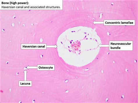 Bone – Normal Histology – NUS Pathweb :: NUS Pathweb