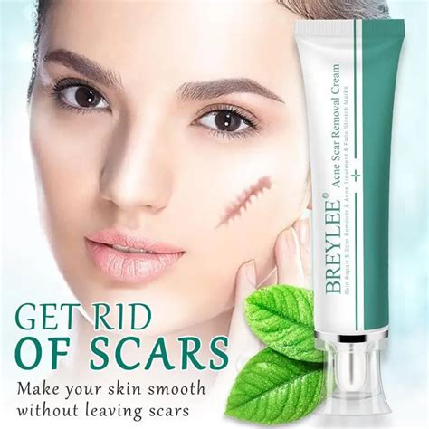 BREYLEE Acne Scar Removal Cream Face Cream Skin Repair Skin Care Scar ...