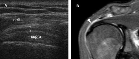 Specific Sites | Radiology Key