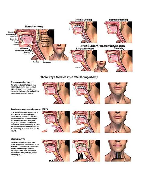 Buy YNB Electronic Larynx Anatomy Human Larynx Scientific Wall Charts ...