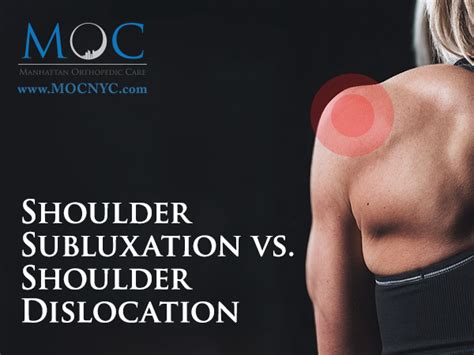 Shoulder Subluxation vs. Shoulder Dislocation