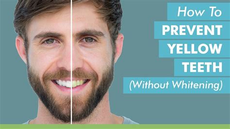 How to Prevent Yellow Teeth (Without Whitening) - YouTube