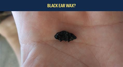 What is black ear wax? – Axel Glade