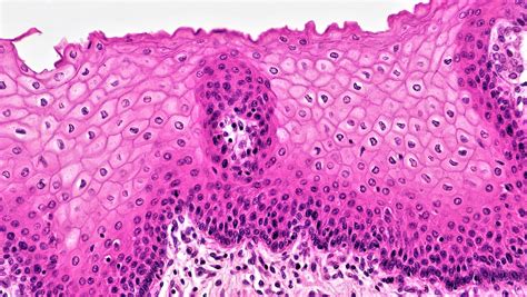 Surface Epithelium: Histology | Concise Medical Knowledge