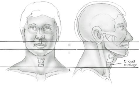 Penetrating Neck Trauma