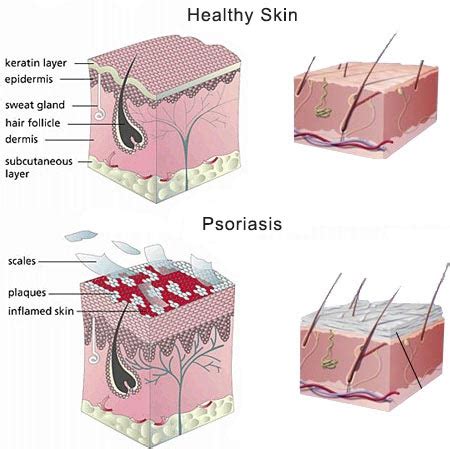 Scalp Psoriasis Specialists · Laser Dermatology · Dermatologist NYC