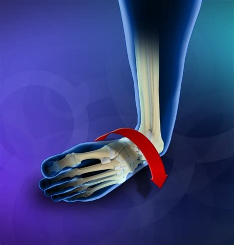 Ankle Instability La Canada | Ankle Ligament Problems Los Angeles ...