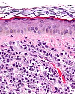 Mast Cells Histology