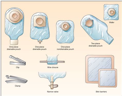 Types Of Colostomy Bags After Surgery | IUCN Water