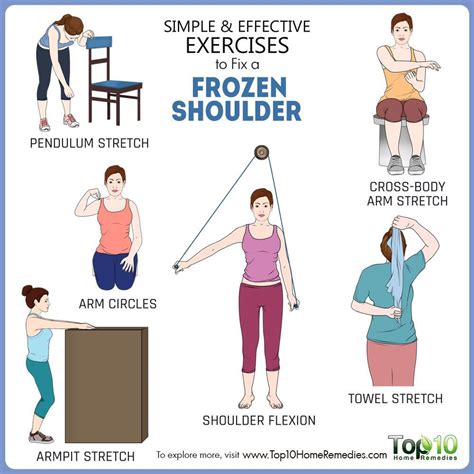 Image result for frozen shoulder | Frozen shoulder, Shoulder workout ...