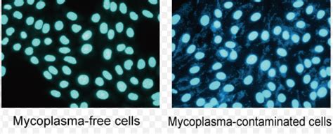 Does it looks like mycoplasma contamination?