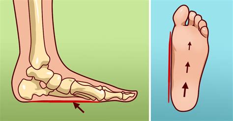 10 Common Causes Of Foot Pain And How To Treat It