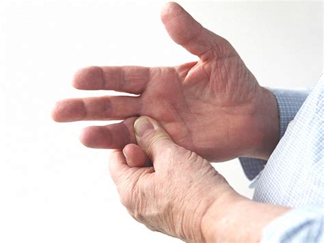 Sprained Finger: Symptoms, Home Treatments, and More