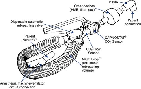 Cardiac Output Measurement | Thoracic Key