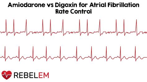 Amiodarone Versus Digoxin for Acute Rate Control of Atrial Fibrillation ...