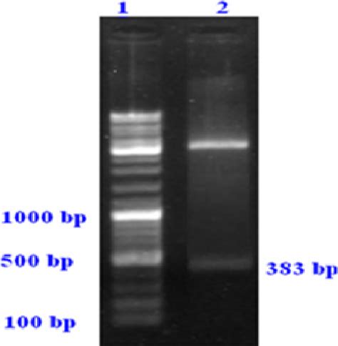 Agarose gel electrophoresis. Lane 1: 100 bp DNA ladder marker. Lane 2 ...