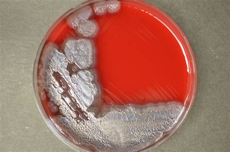 Pseudomonas aeruginosa is one of the most distinctive organisms in the ...