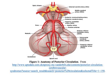 emDOCs.net – Emergency Medicine EducationPosterior Circulation Strokes ...