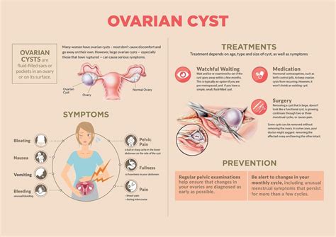 FB live session Ovarian cysts Dr. Rimmy | Singla Mediclinic