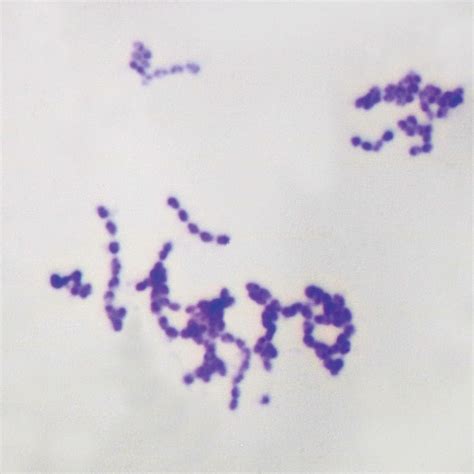 Streptococcus Pneumoniae Under Microscope