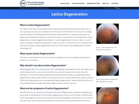 Lattice Degeneration - Retina-Vitreous Surgeons of CNY