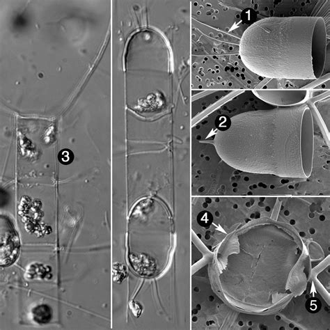 Image Chaetoceros_lauderi_guide.jpg | Species - Diatoms of North America