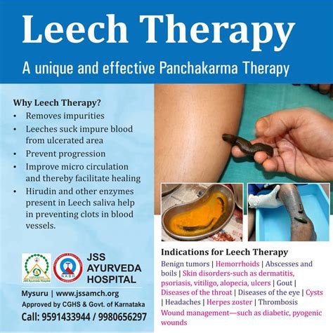 Leech Therapy - A unique and effective Panchakarma Therapy - JSS ...