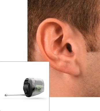 Hearing Aid Styles | University of the Pacific