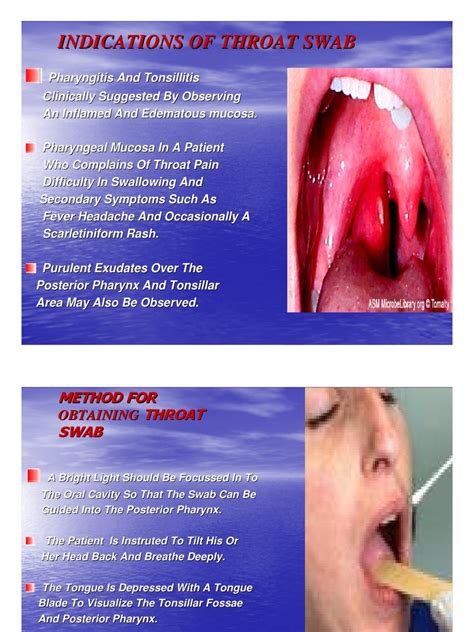 Indications of Throat Swab | Streptococcus | Health Sciences