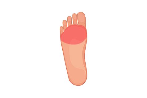 Synovitis: Causes, Symptoms & Treatment - Dr Foot Podiatry