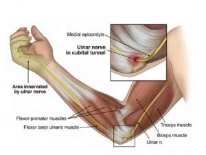 Funny bones aren’t funny | SiOWfa14 Science in Our World: Certainty and ...