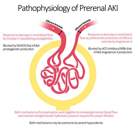 Acute renal failure pathophysiology - wikidoc