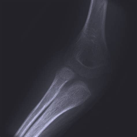 Hand & Wrist - Melbourne Orthopaedic Group are specialists in many ...