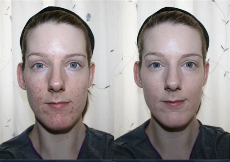 Vichy Dermablend Porcelain 05 Before and After - Beauty Geek UK