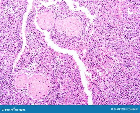 Histology of Human Pancreas Tissue Stock Photo - Image of pathology ...