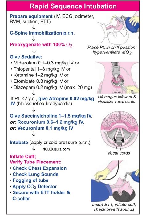 Rapid Sequence Intubation Algorithm - NCLEX Quiz