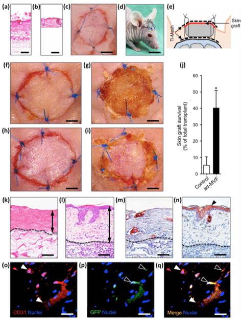 Autologous skin grafting. (a-e) HE-stained sections of a skin graft ...