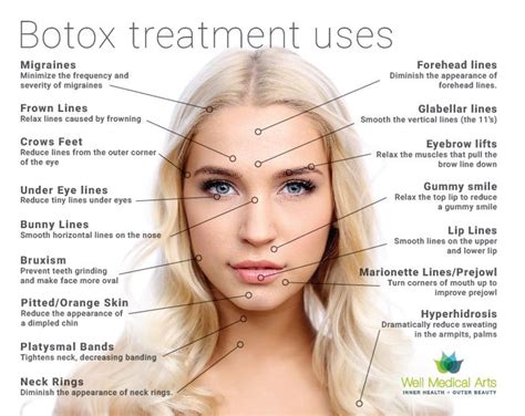 Image result for before and after pictures for botox for DAO | Botox ...