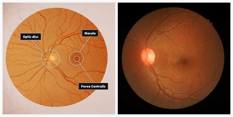 Eye Model Labeled Fovea Centralis