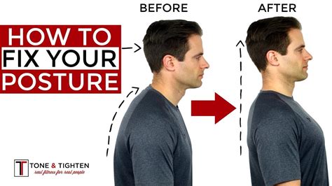 How To Correct Your Posture - 5 Home Exercises To Fix Your Posture ...