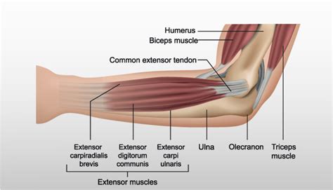 Physical Therapy for Tennis Elbow-Mangiarelli Rehabilitation