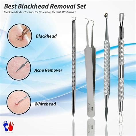 BLACKHEAD REMOVER TOOL KIT SPOT ACNE PIMPLE COMEDONE TWEEZERS EXTRACTOR ...