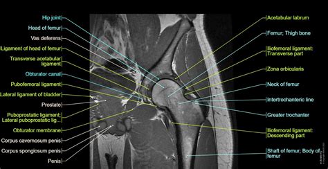 The hip anatomy on 3T MR and 3D pictures | e-Anatomy