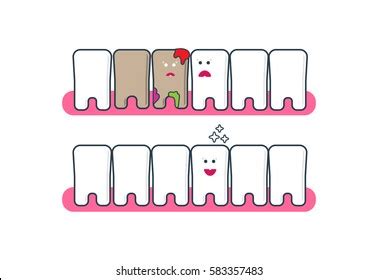 Funny Cartoon Teeth Characters Before After Stock Vector (Royalty Free ...