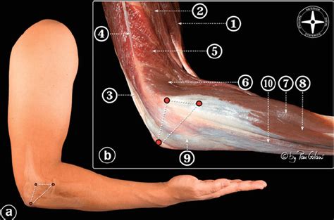 ( a ) Lateral view of the elbow showing the surface anatomy of the soft ...