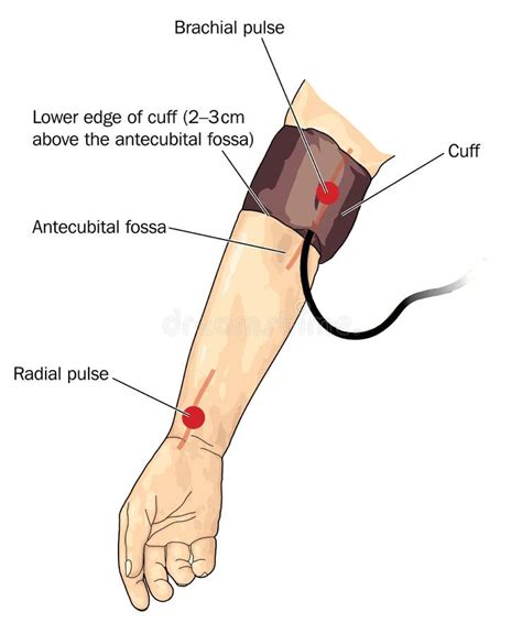 Stressful bathing Nationwide blood pressure cuff on arm mild engineer ...