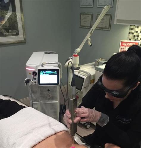 Laser Tattoo Removal North Vancouver | home salabrasion tattoo removal